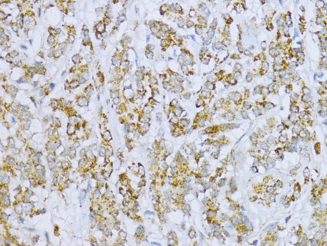 Aconitase 2 Antibody in Immunohistochemistry (Paraffin) (IHC (P))