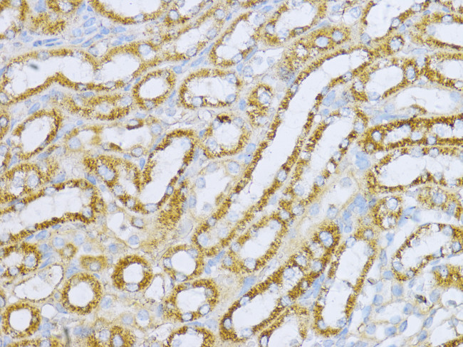 Aconitase 2 Antibody in Immunohistochemistry (Paraffin) (IHC (P))