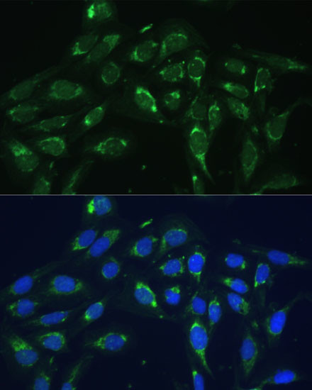 COX6A1 Antibody in Immunocytochemistry (ICC/IF)