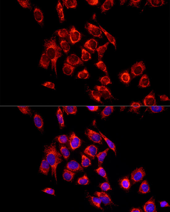 ECHS1 Antibody in Immunocytochemistry (ICC/IF)