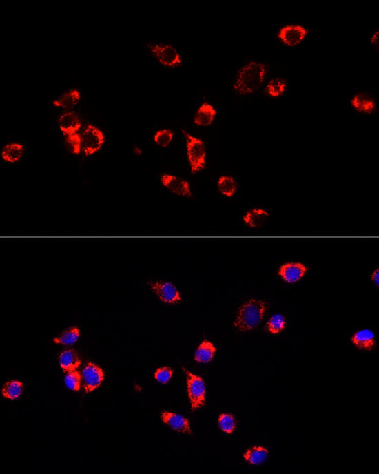 ECHS1 Antibody in Immunocytochemistry (ICC/IF)