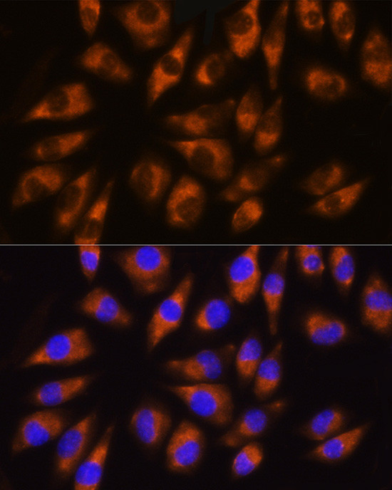 GRK5 Antibody in Immunocytochemistry (ICC/IF)