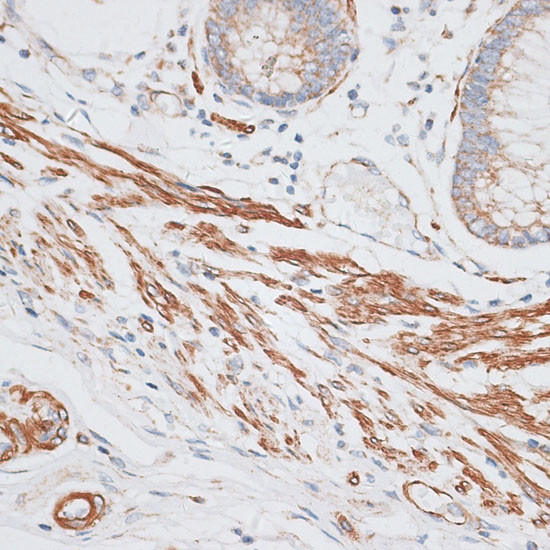 GRK5 Antibody in Immunohistochemistry (Paraffin) (IHC (P))