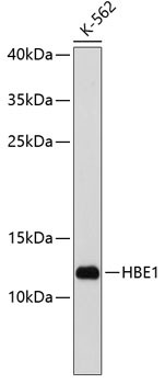 HBE1 Antibody in Western Blot (WB)