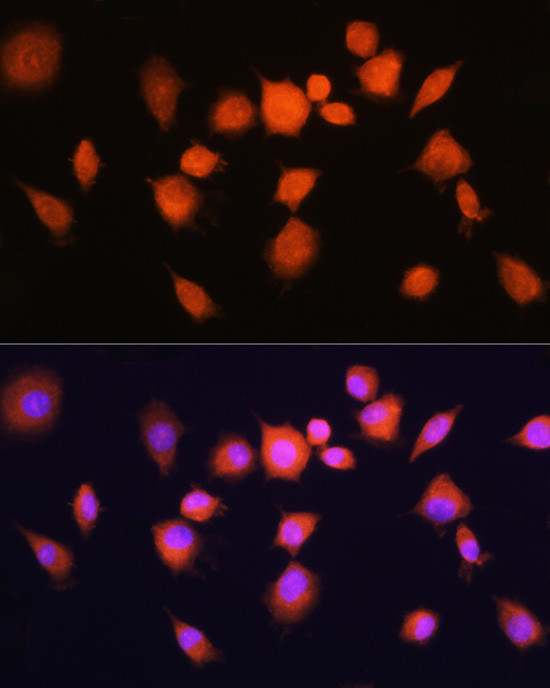 PGAM1 Antibody in Immunocytochemistry (ICC/IF)