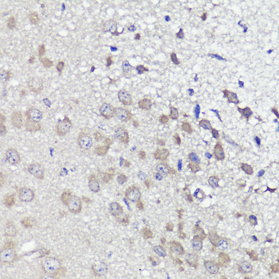 UBL3 Antibody in Immunohistochemistry (Paraffin) (IHC (P))