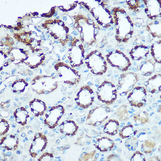 UQCRC2 Antibody in Immunohistochemistry (Paraffin) (IHC (P))