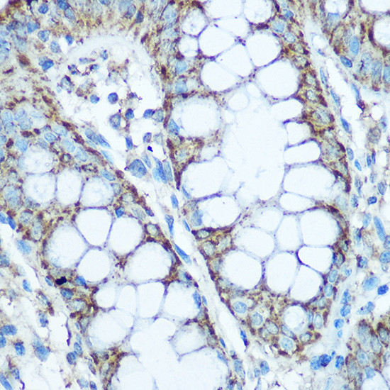 UQCRC2 Antibody in Immunohistochemistry (Paraffin) (IHC (P))