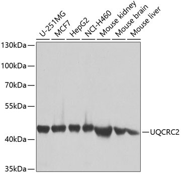 UQCRC2 Antibody in Western Blot (WB)