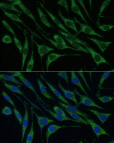 VARS Antibody in Immunocytochemistry (ICC/IF)