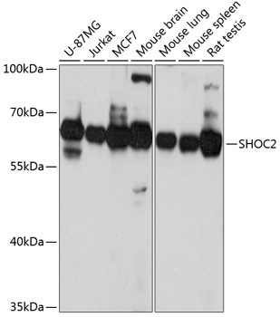 SHOC2 Antibody in Western Blot (WB)