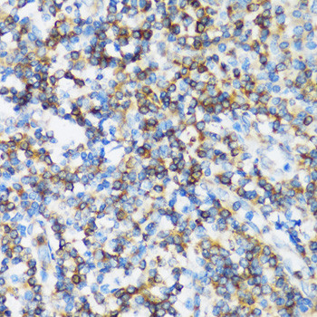 ARHGEF1 Antibody in Immunohistochemistry (Paraffin) (IHC (P))