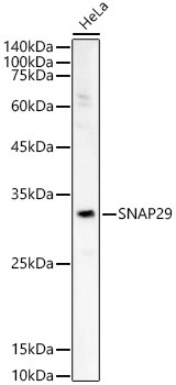 SNAP29 Antibody in Western Blot (WB)