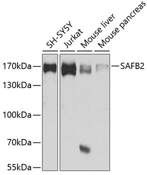 SAFB2 Antibody in Western Blot (WB)