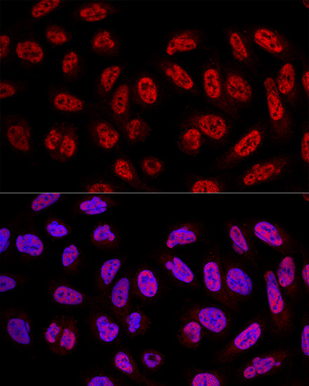 SF3A3 Antibody in Immunocytochemistry (ICC/IF)