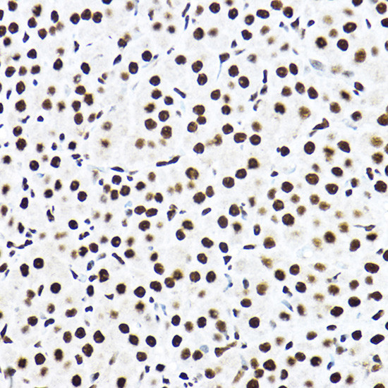 SF3A3 Antibody in Immunohistochemistry (Paraffin) (IHC (P))