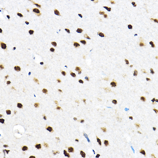 SF3A3 Antibody in Immunohistochemistry (Paraffin) (IHC (P))