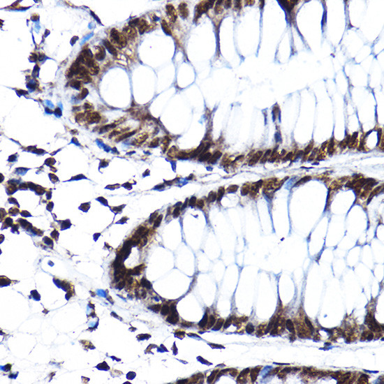 SF3A3 Antibody in Immunohistochemistry (Paraffin) (IHC (P))