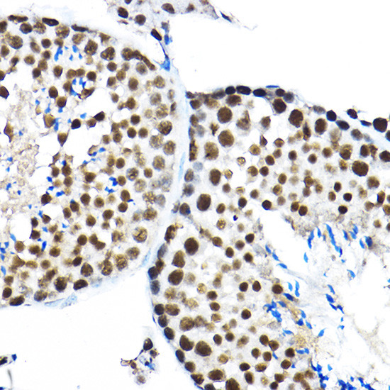 SF3A3 Antibody in Immunohistochemistry (Paraffin) (IHC (P))