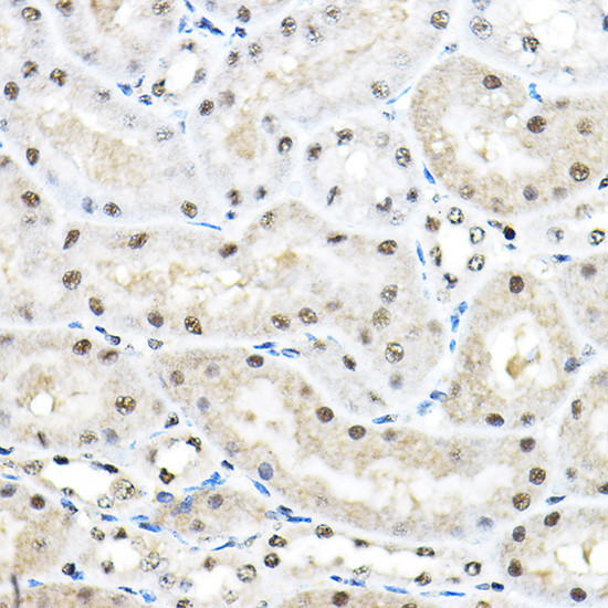 SF3A3 Antibody in Immunohistochemistry (Paraffin) (IHC (P))