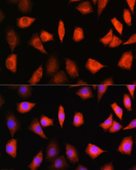 KAP3 Antibody in Immunocytochemistry (ICC/IF)