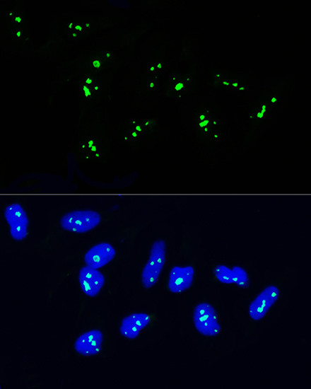 NOP58 Antibody in Immunocytochemistry (ICC/IF)