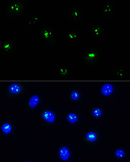 NOP58 Antibody in Immunocytochemistry (ICC/IF)