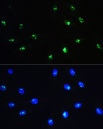 NOP58 Antibody in Immunocytochemistry (ICC/IF)