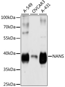 NANS Antibody in Western Blot (WB)