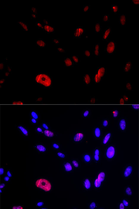 HUS1 Antibody in Immunocytochemistry (ICC/IF)