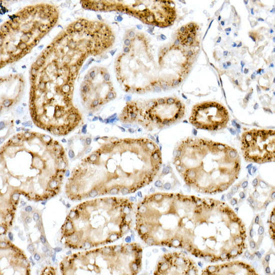 NPC2 Antibody in Immunohistochemistry (Paraffin) (IHC (P))