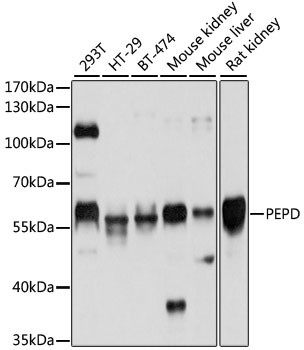 PEPD Antibody in Western Blot (WB)