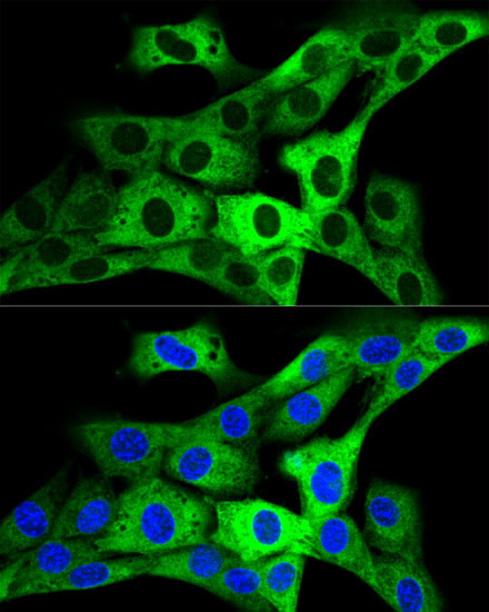 GARS Antibody in Immunocytochemistry (ICC/IF)