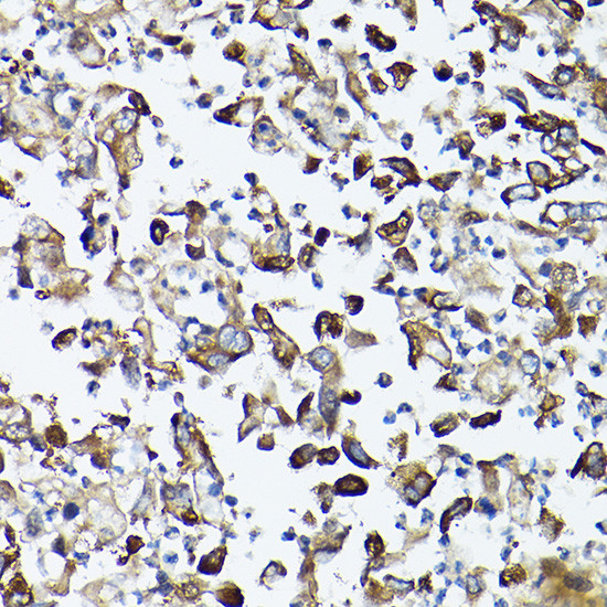 GARS Antibody in Immunohistochemistry (Paraffin) (IHC (P))