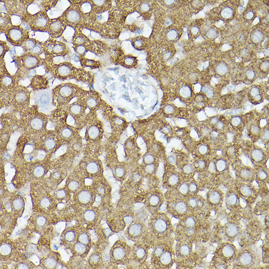 GARS Antibody in Immunohistochemistry (Paraffin) (IHC (P))