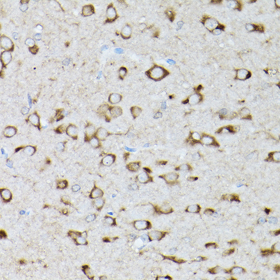 GARS Antibody in Immunohistochemistry (Paraffin) (IHC (P))