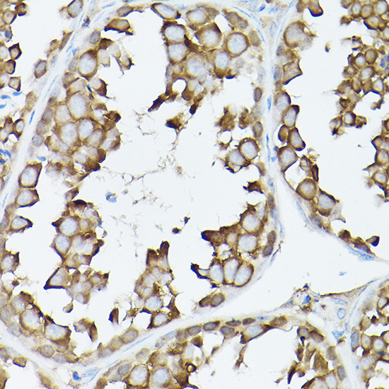 GARS Antibody in Immunohistochemistry (Paraffin) (IHC (P))