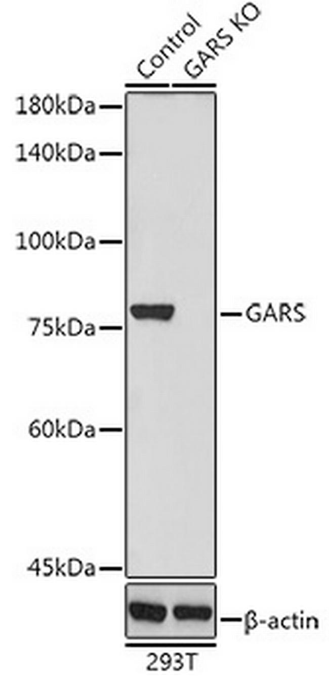 GARS Antibody