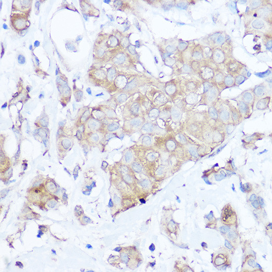 MGP Antibody in Immunohistochemistry (Paraffin) (IHC (P))