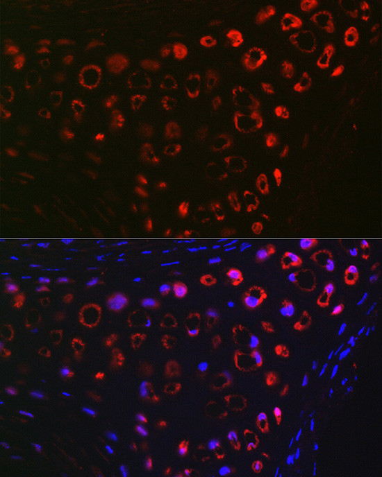 MGP Antibody in Immunohistochemistry (Paraffin) (IHC (P))