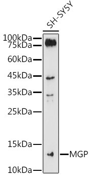 MGP Antibody in Western Blot (WB)