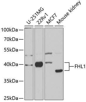 FHL1 Antibody in Western Blot (WB)