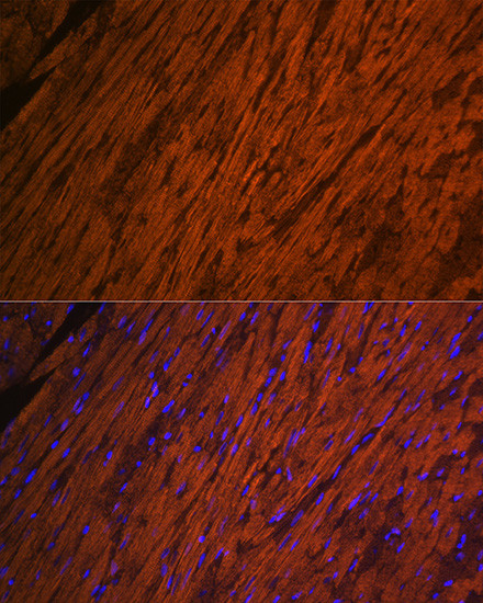 MYL2 Antibody in Immunohistochemistry (Paraffin) (IHC (P))