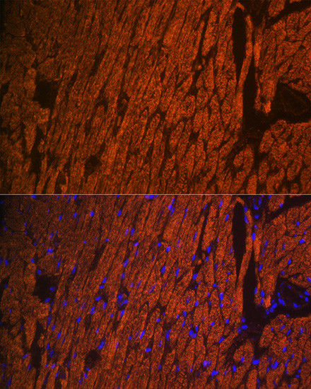 MYL2 Antibody in Immunohistochemistry (Paraffin) (IHC (P))