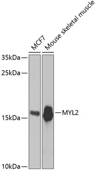 MYL2 Antibody in Western Blot (WB)