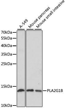 PLA2 Antibody in Western Blot (WB)