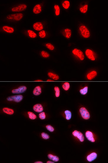 PRPF3 Antibody in Immunocytochemistry (ICC/IF)