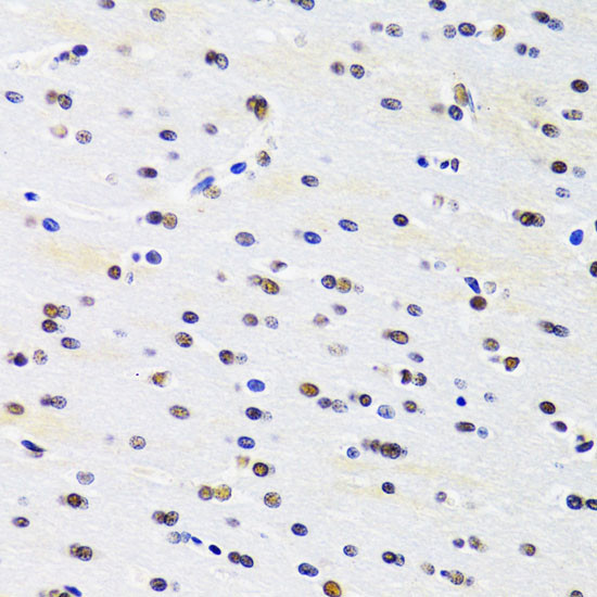 PRPF3 Antibody in Immunohistochemistry (Paraffin) (IHC (P))