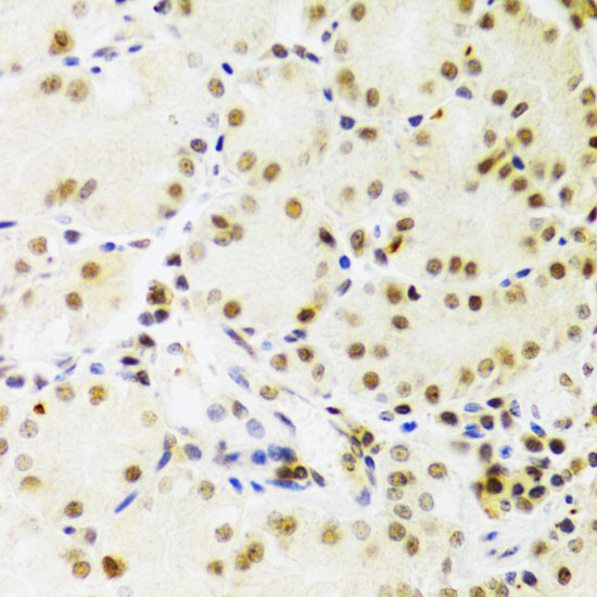 PRPF3 Antibody in Immunohistochemistry (Paraffin) (IHC (P))