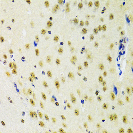 PRPF3 Antibody in Immunohistochemistry (Paraffin) (IHC (P))